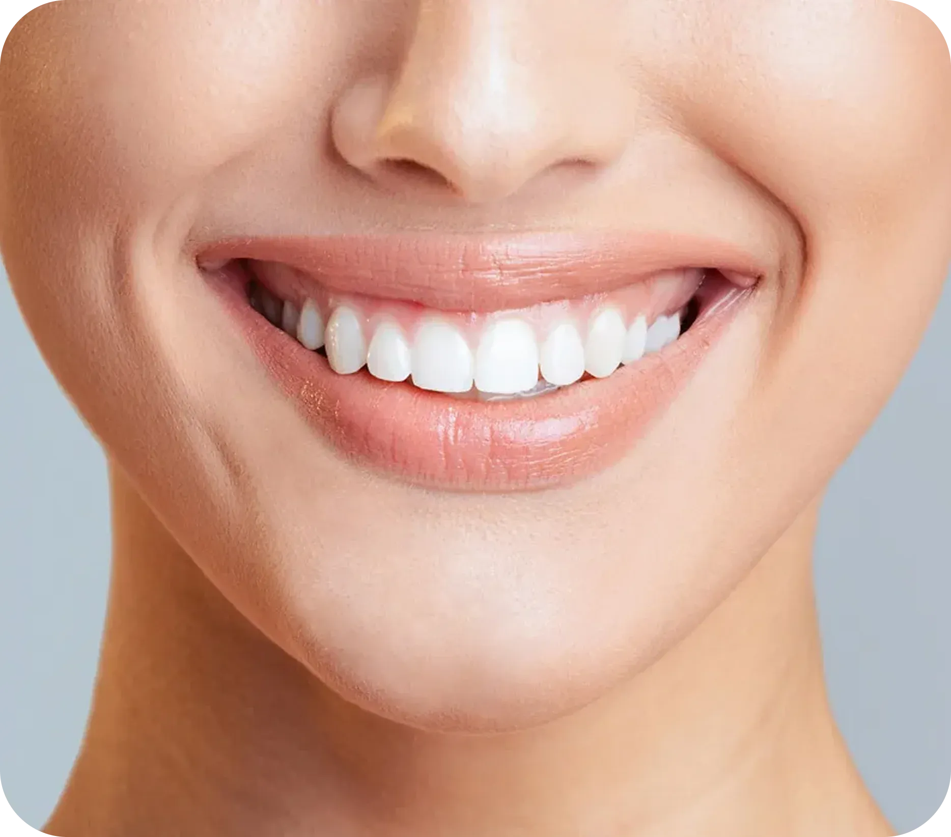 Dental Crowns