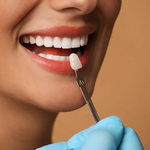 Hollywood Smile